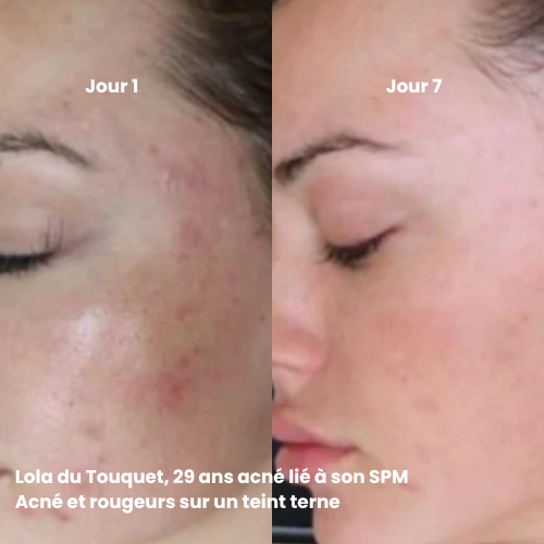 Crème Douceur Régénérante "Réparation nocturne & éclat de jeunesse" - Nuit 50ml