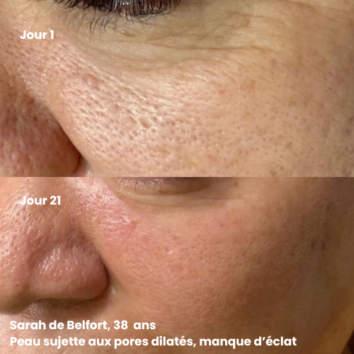 Mousse Éclat Nettoyante & Exfoliante — Booster de teint 150ML - 300 utilisations