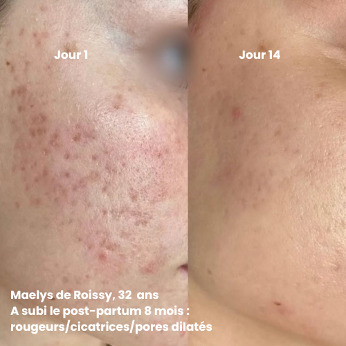 Coffret Rituel Divin — Routine anti-âge complète & naturelle