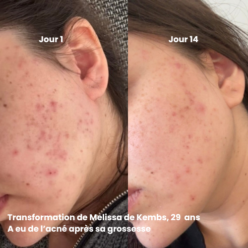 Coffret Rituel Divin — Routine anti-âge complète & naturelle