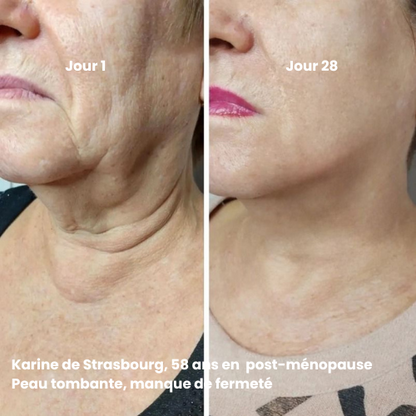 Routine Stylo Led 4 en 1 & Crème Anti-rides