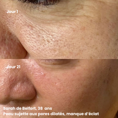 Mousse Éclat Nettoyante & Exfoliante — Booster de teint 150ML - 300 utilisations