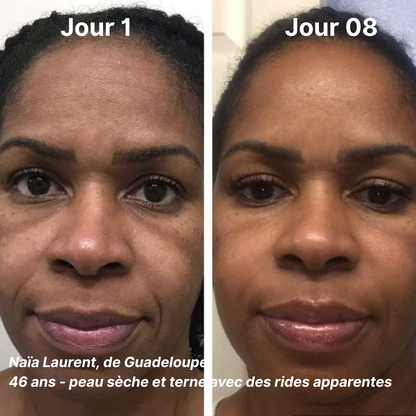 Routine Stylo Led 4 en 1 & Crème Anti-rides